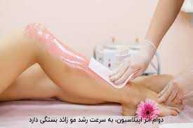 زیبایی آرارخ
